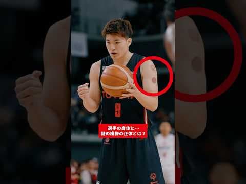 皆さんも気になっていた“あの模様”🤔「カッピング」と呼ばれる治療法！#アルバルク東京 #バスケ #Bリーグ #basketball