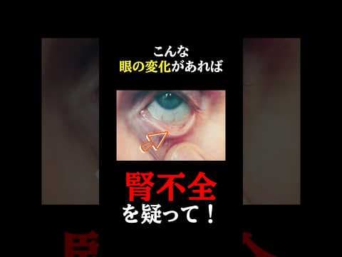 放置厳禁！知らないと後悔する「腎不全」が引き起こす眼の変化。#医師#腎不全#予防医学チャンネル