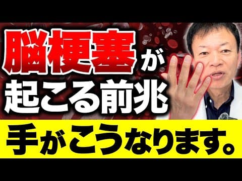 【”隠れ”脳梗塞のサイン】手が〇〇の人は今すぐ気をつけて！40代以上は絶対知っておくべき血管の新常識
