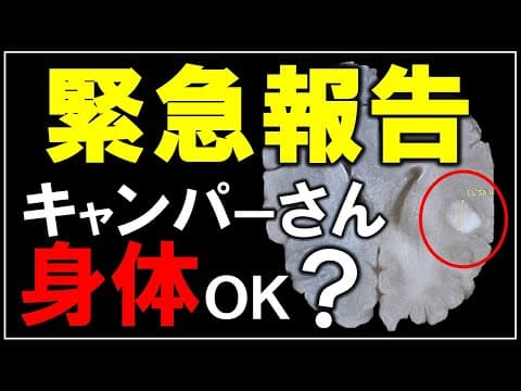 【緊急報告！】脳腫瘍でDIYもキャンプも一時休止。身体のサインに注意し皆さん長生きを【DIY キャンプ 186】
