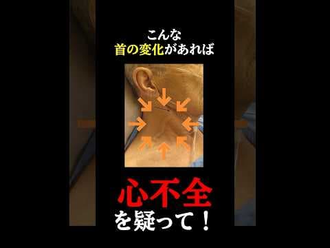 【危険】知らないと後悔する心不全の超意外な危険サインとは？ #予防医学チャンネル#心不全