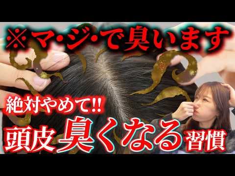 【臭い対策】絶対にやってはいけない頭皮が臭う原因になる習慣！簡単に頭皮のニオイは消せます！